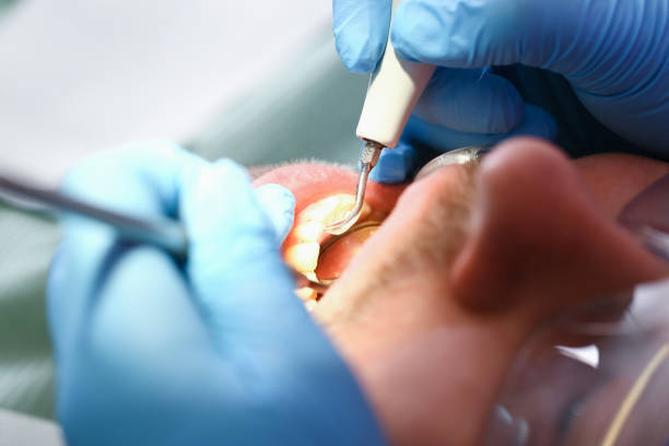 Best Emergency Treatment for Oral Infections in Washburn, ND