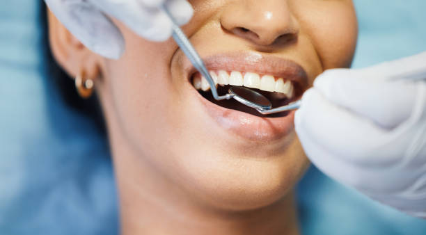 Best 24-Hour Emergency Dental Care in Washburn, ND
